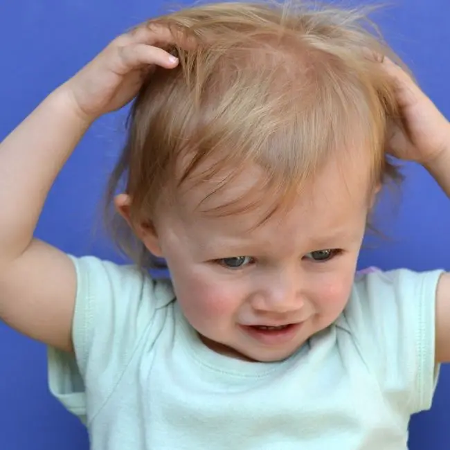 baby scratching back of head