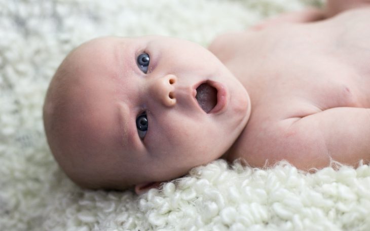 1 Month Old Baby with sparse brows